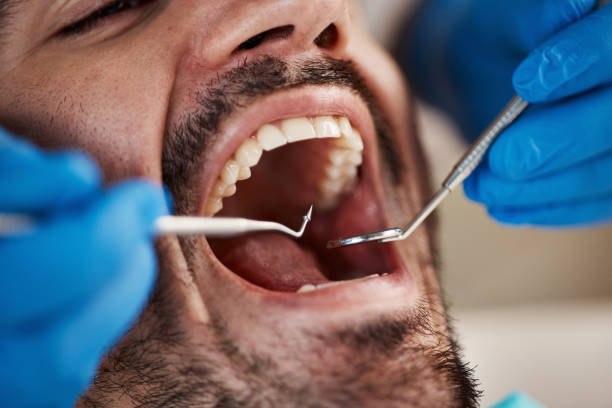 Best Emergency Root Canal Treatment in Roman Forest, TX